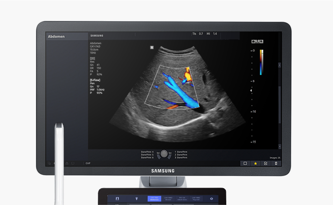 SAMSUNGMEDICAL 장비